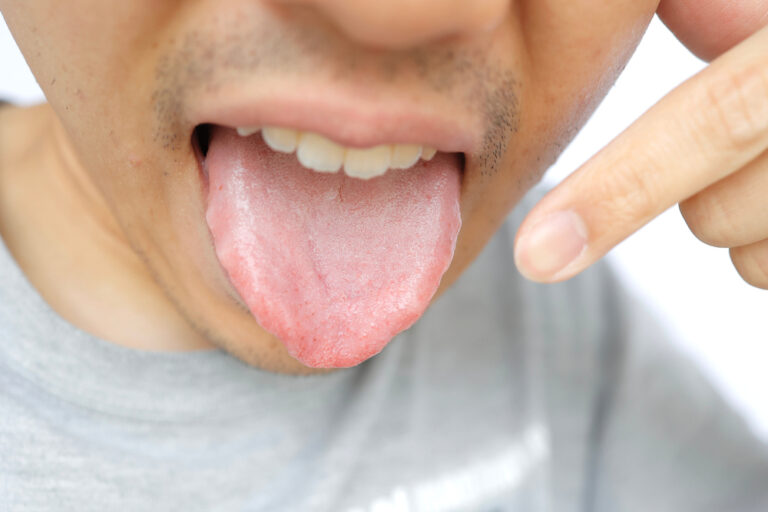 Banish Bad Breath: The Simple Habit That Makes a Big Difference
