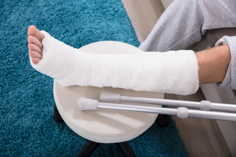 Rethinking osteoporosis beyond calcium intake