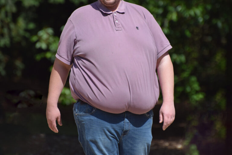 Study suggests obesity may speed up Alzheimer’s development