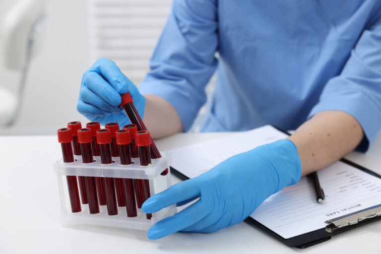 New guidelines recommend earlier cholesterol screening