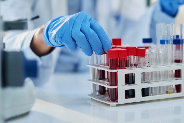 Blood test may reveal older adults’ risk of early death