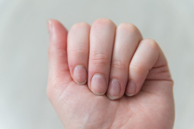 Changes in your nails may reveal information about your health