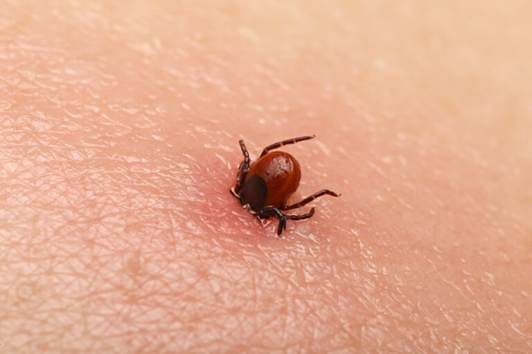 Rare tick-borne illness sees unusual increase across the U.S.