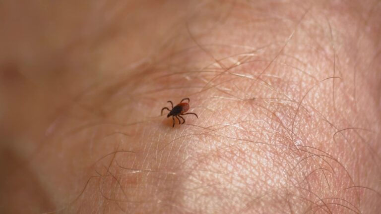 Tick-borne encephalitis: Understanding TBE and how to stay protected