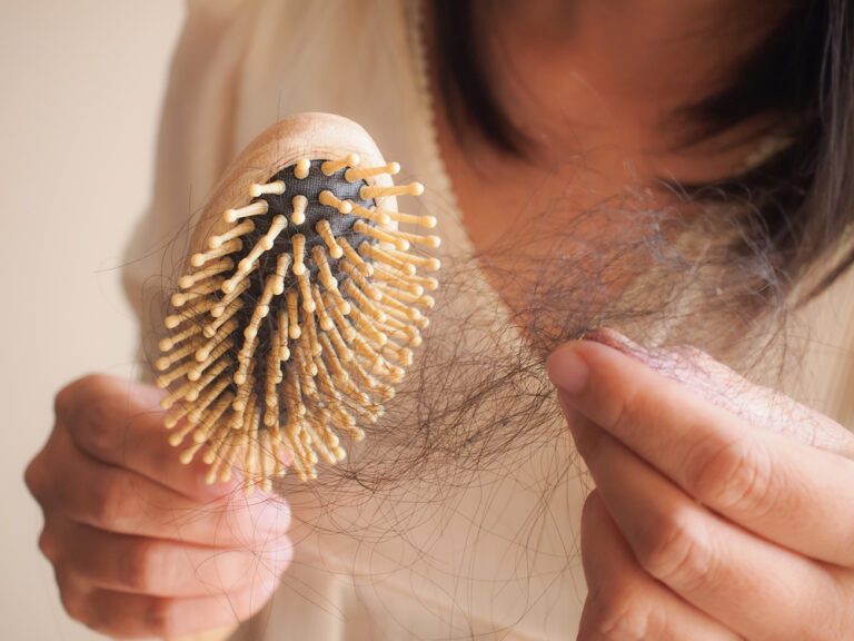 Popular weight-loss drugs face new hair loss questions