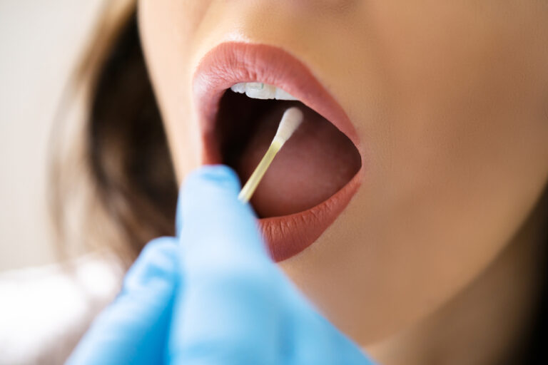 These common mouth changes could be darly warning signs of oral cancer