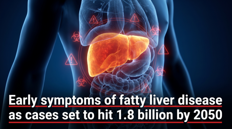 Thumbnail Early symptoms of fatty liver disease as cases set to hit 1.8 billion by 2050