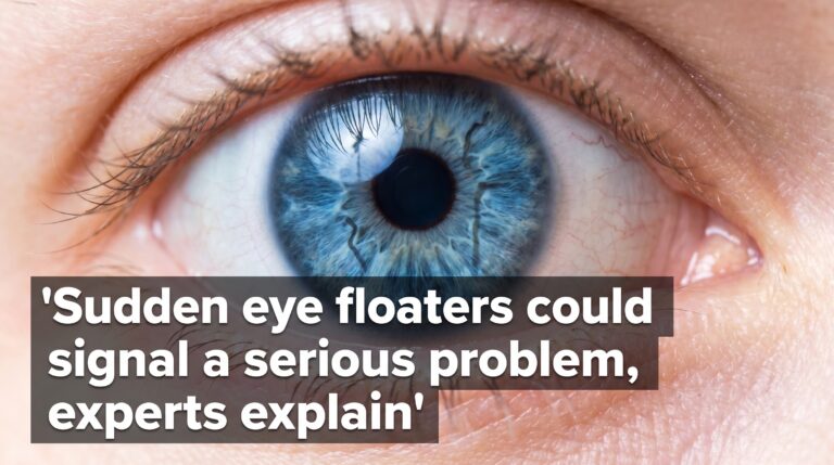 Thumbnail Sudden eye floaters could signal a serious problem, experts explain