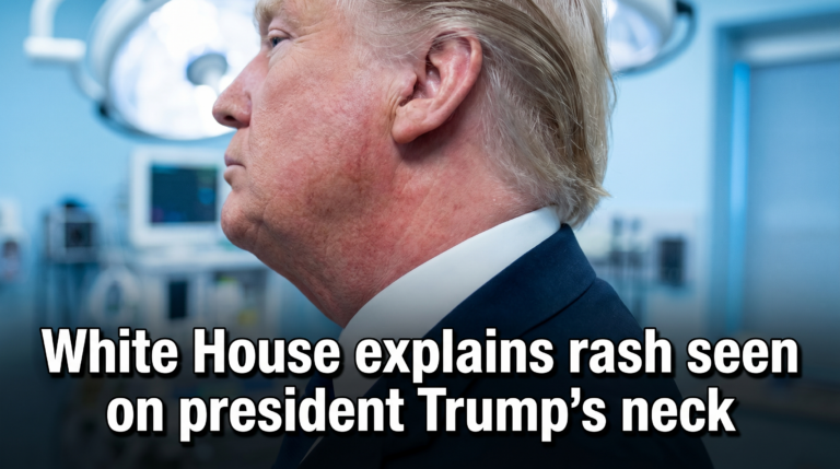 Thumbnail White house explains rash seen on president trump