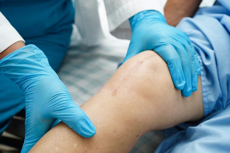 Medication could reduce the need for knee replacements in osteoarthritis patients