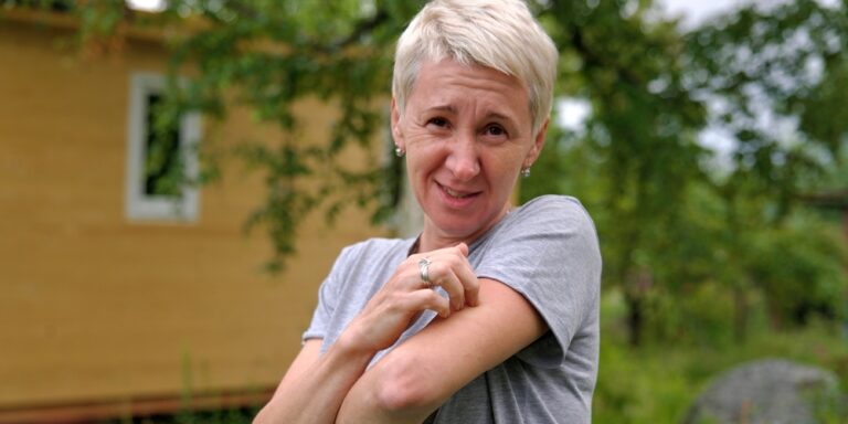 Does your body itch all the time? Scientists may have found the reason